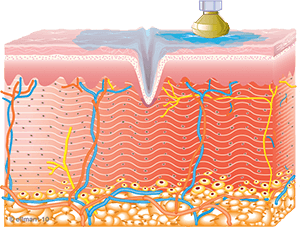 Collagen Synthesis